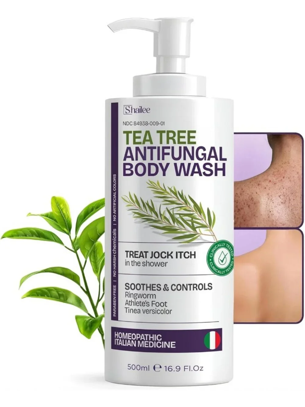 Antifungal Body Wash with Tea Tree Oil | Eczema & Acne Treatment Soap 16.9oz
